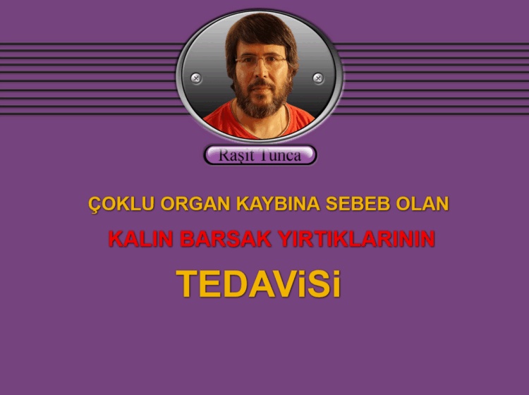 ÇOKLU ORGAN KAYBINA SEBEB OLAN KALIN BARSAK YIRTIKLARININ TEDAViSi