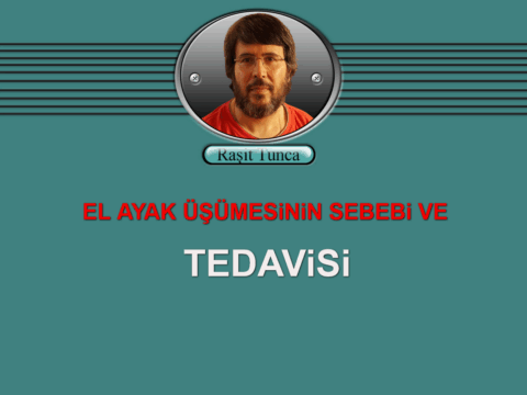 EL AYAK ÜŞÜMESiNiN SEBEBi VE TEDAViSi